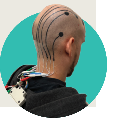 um jovem com os eletrodos conectados a tatuagem na cabeça.