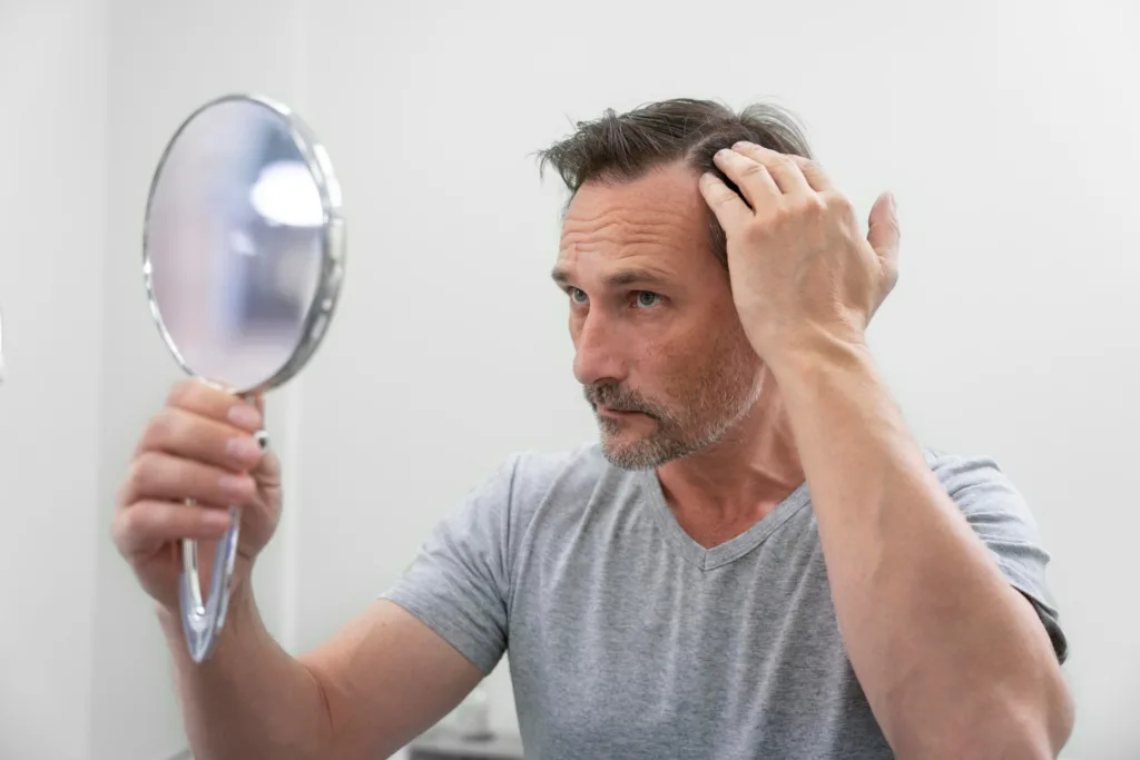 homem olhando no espelho para verificar se seu cabelo esta caindo.