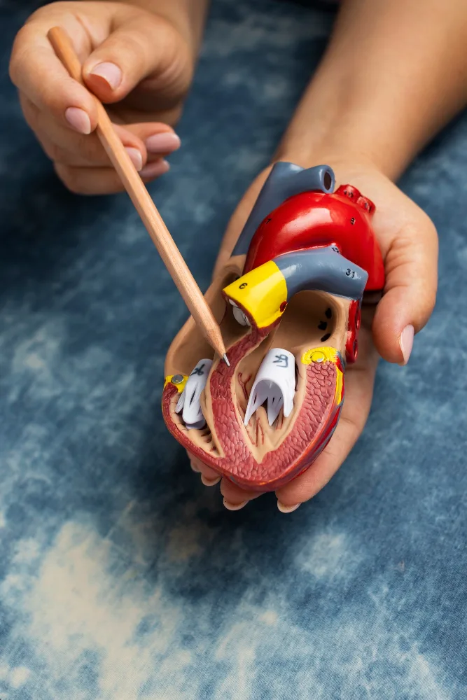 Comparação visual de artérias saudáveis e artérias com placas causadas por lipoproteína(a)