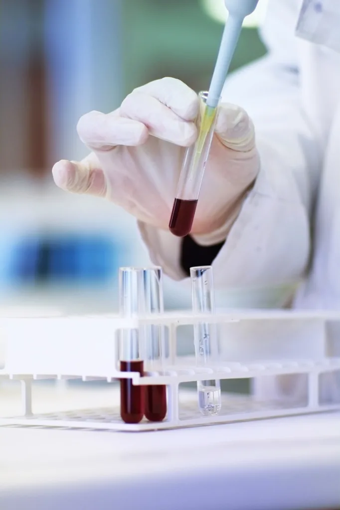 imagem de uma mão colocado um recipiente com sangue coletado em um laboratório.