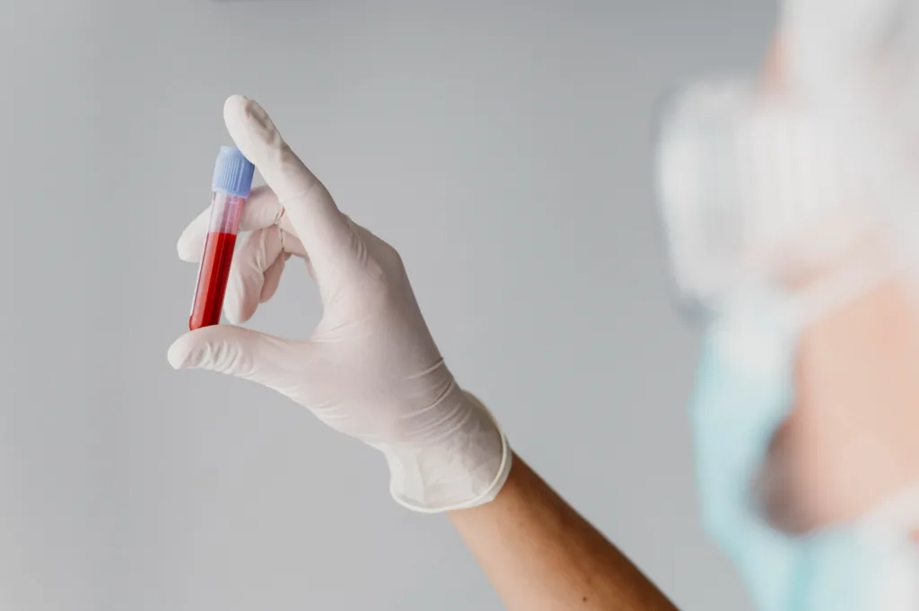 pessoa segurando um tibo de ensaio com sangue para exame.