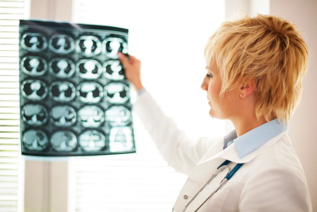 medica analisando uma imagem diagnostica de um cerebro.