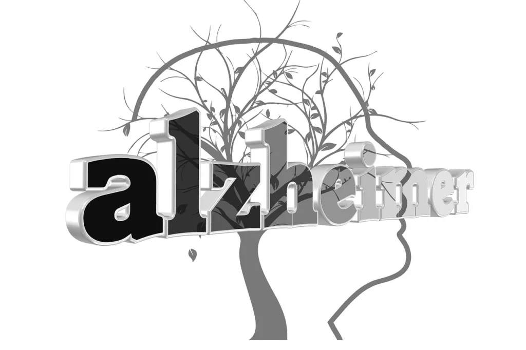 arte do Alzheimer.